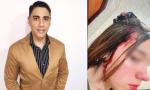 Escándalo y violencia: conocido dueño de un gimnasio acabó detenido por golpear y viralizar fotos de su ex pareja.