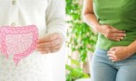 Salud y bienestar Cuáles son los 6 peores alimentos para la salud intestinal.