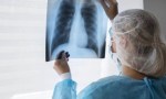 Alerta sanitaria nacional: «Hay un aumento de la tuberculosis en las poblaciones vulnerables".