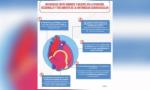 Preocupa la cada vez más alta incidencia de la Enfermedad Cardio Vascular en las mujeres.