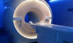 Un hombre muere tras ser succionado por una máquina de resonancia magnética.