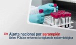 Salud Pública refuerza la vigilancia epidemiológica ante la alerta nacional por sarampión