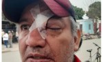 Represión en Yrigoyen: un trabajador perdió un ojo y hay otros muy comprometidos