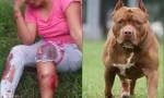 Una joven salteña se encuentra internada tras ser atacada por un pitbull