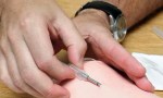 Anmat aprobó un nuevo “chip anticonceptivo”: el 27% de las adolescentes ya usan implantes subdérmicos.
