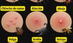 ¿Qué insecto te picó? Aprende a reconocerlo